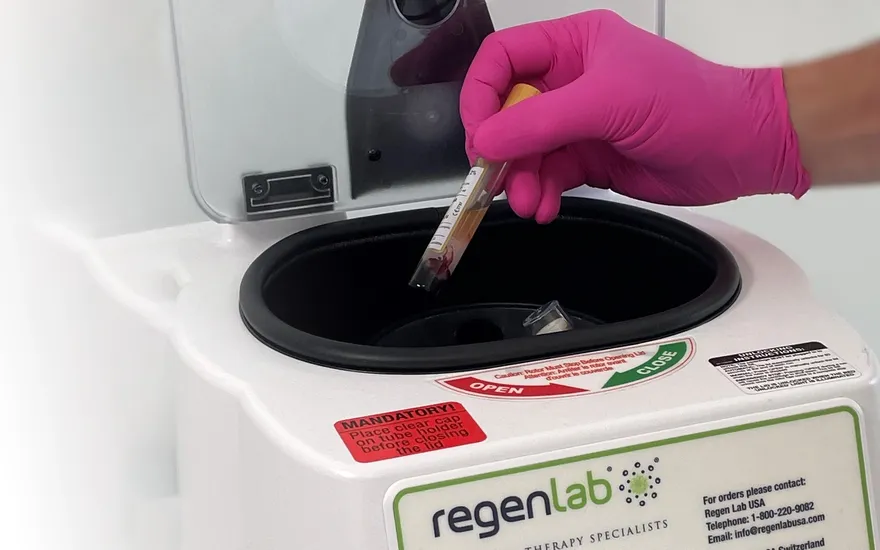 Ein Röhrchen mit Eigenblut wird in das Regenlab Gerät zur Rotation eingesetzt