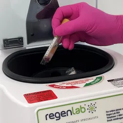 Ein Röhrchen mit Eigenblut wird in das Regenlab Gerät zur Rotation eingesetzt